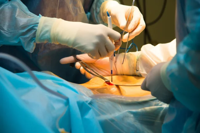 minimal-surgery-indore.webp
